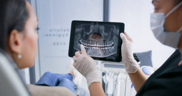 Licensed Teeth Cleaning And Checkup service in Rosemount, OH - Smile Center Dentistry